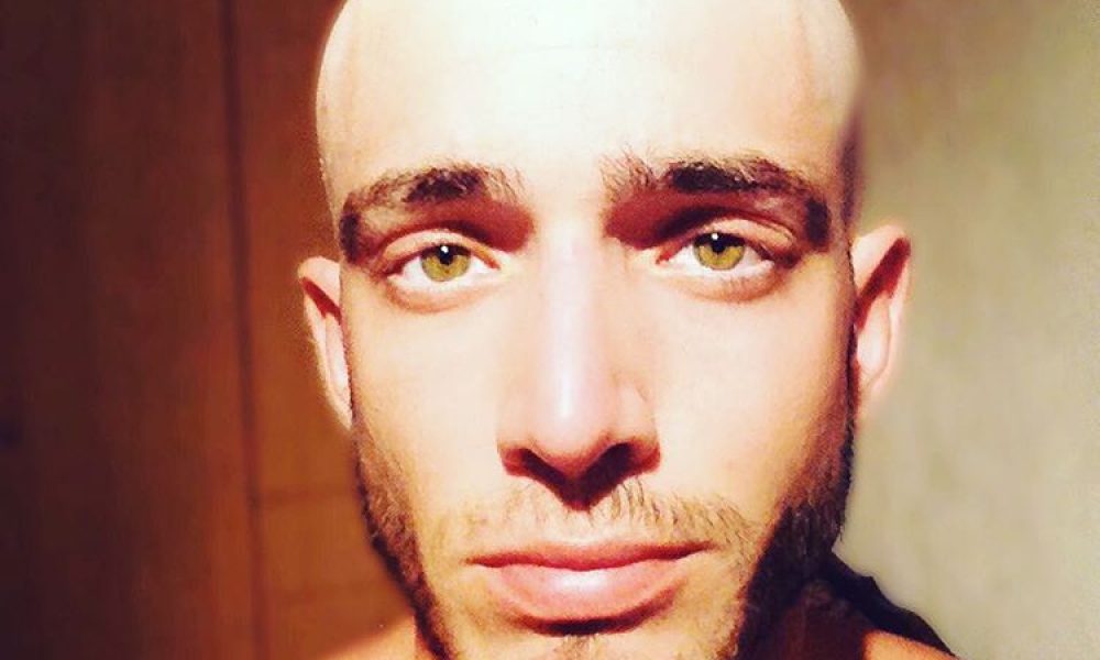 Ο Θεοχάρης Ιωαννίδης ποζάρει χωρίς μαλλιά και μιλά για το πρόβλημα υγείας του