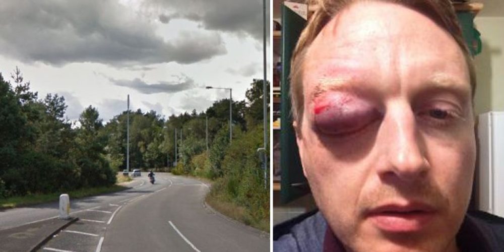 Ποδηλάτης κόντεψε να χάσει το μάτι του από αυγό που πετάχτηκε από διερχόμενο αυτοκίνητο (Photos)